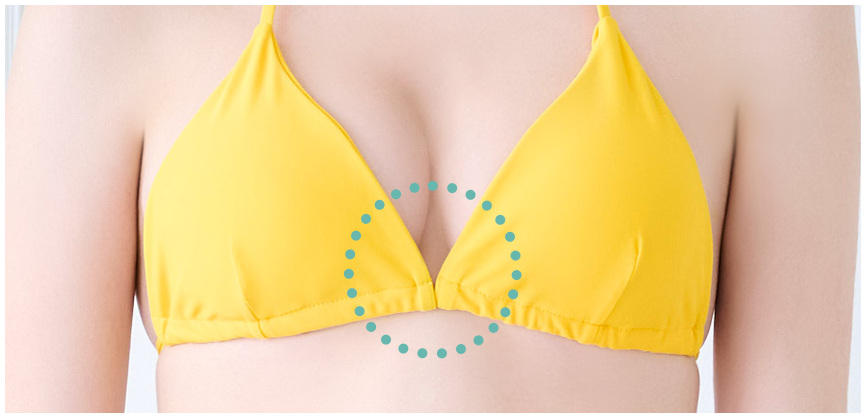 NuBra（ヌーブラ）】水着用ヌーブラで劇的谷間メイク！ヌーブラ