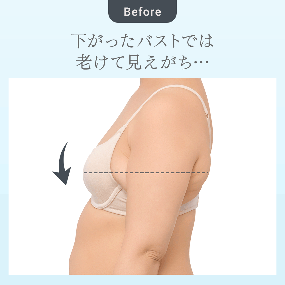 ビフォーアフター