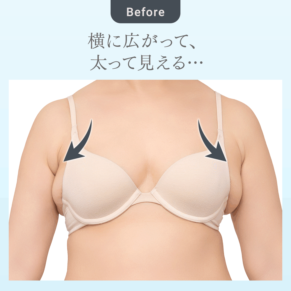 ビフォーアフター