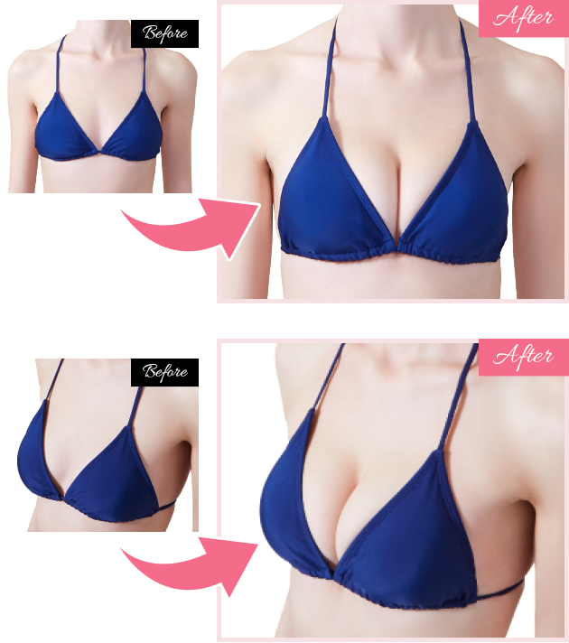 水着用 ヌーブラビーチ徹底解説 ヌーブラ公式通販