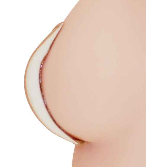 側面：位置が下がり過ぎている