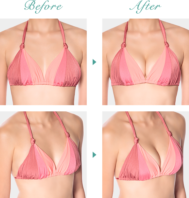 まるで豊胸!?デコルテふっくらボリュームUP!ビフォーアフターイメージ画像