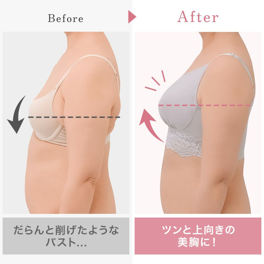 ビフォーアフター